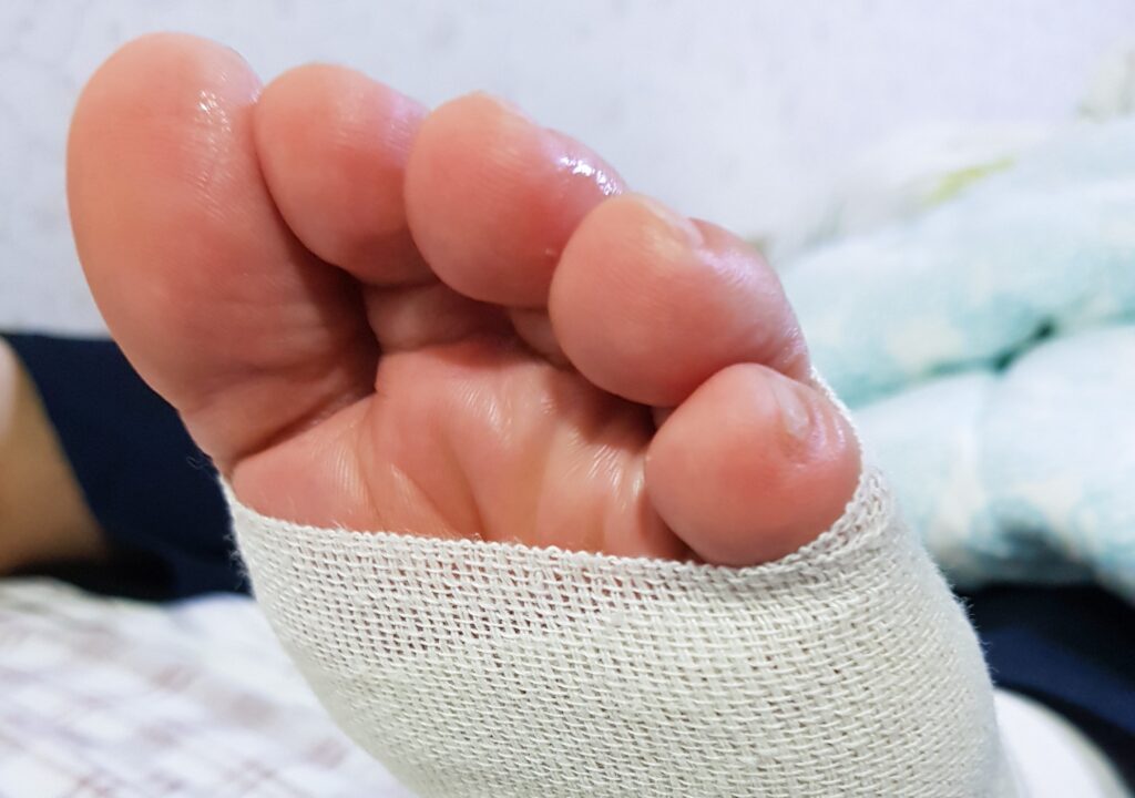 feet-leg-sole-toes-foot-barefoot-1705902-pxhere.com (1)